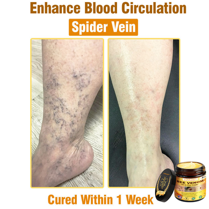 LOVILDS™ Bee Venom Cream – 🌸 Anti-Aging, Hydrating & Skin Repair