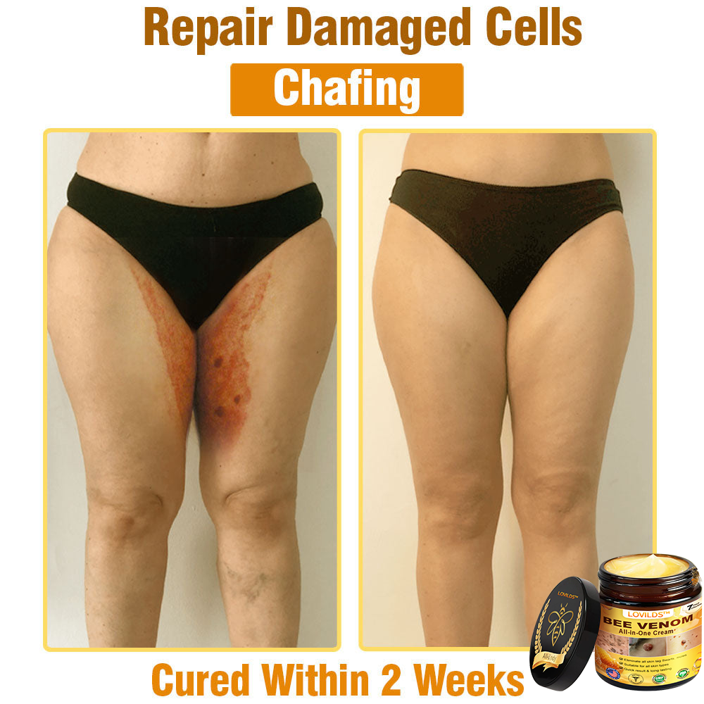 LOVILDS™ Bee Venom Cream – 🌸 Anti-Aging, Hydrating & Skin Repair